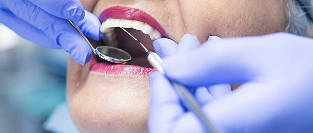 Best Emergency Treatment for Dental Infections or Abscesses in Wamego, KS